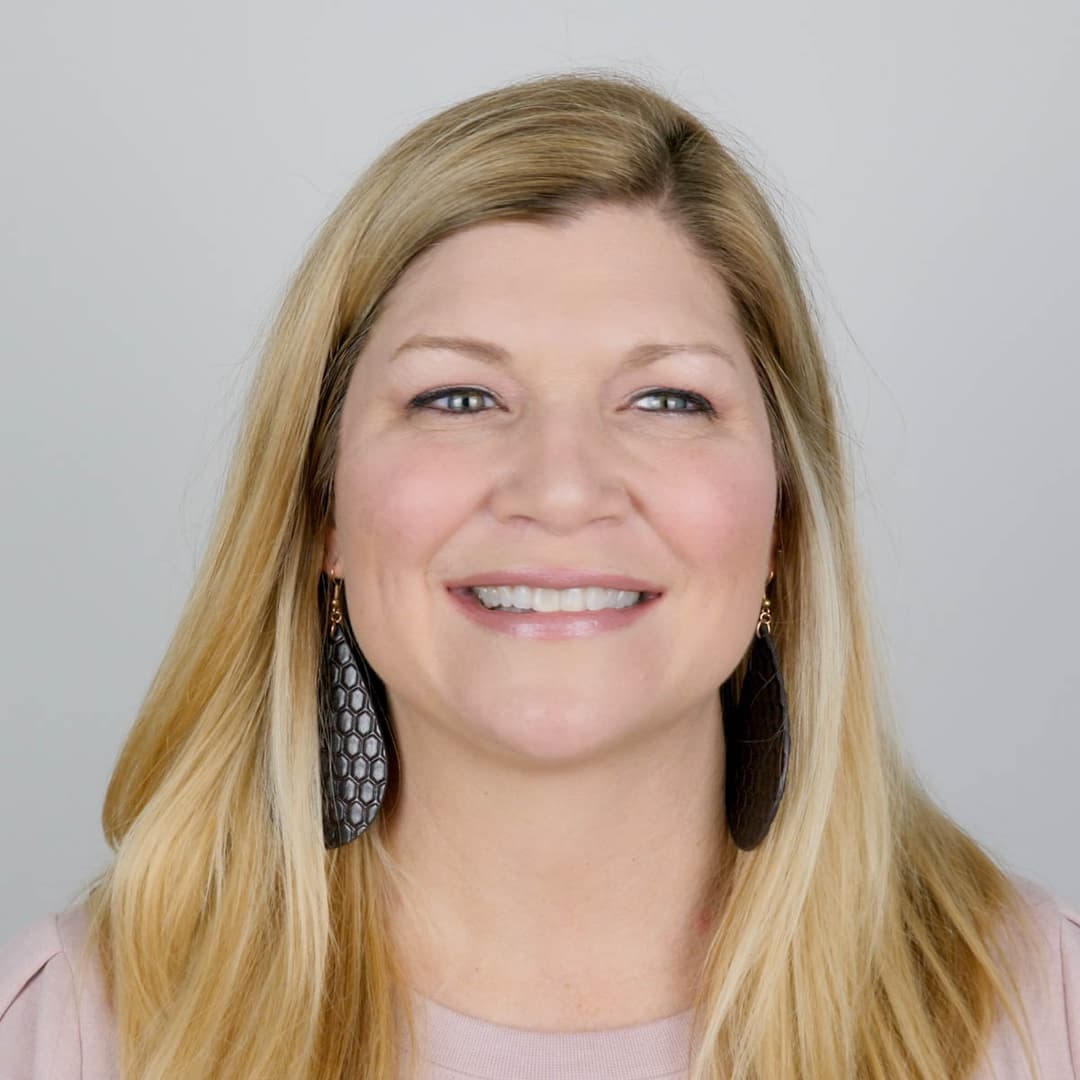 Before image 3 cc/syringes of Restylane in the tear troughs, nasal labial folds and jowls. Also, 2 cc/syringes of Restylane Lyft in the cheeks.