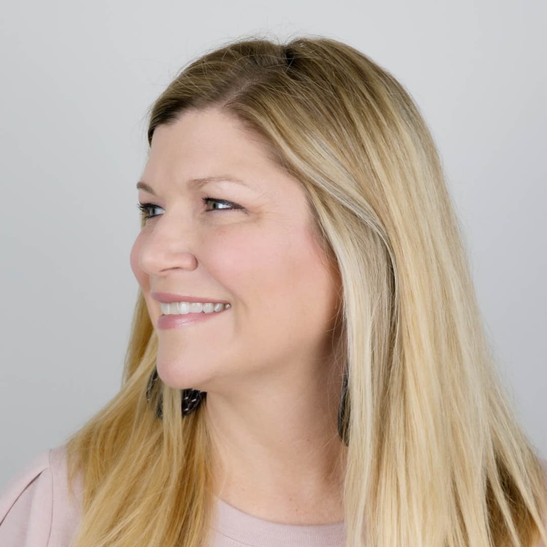 Before image 3 cc/syringes of Restylane in the tear troughs, nasal labial folds and jowls. Also, 2 cc/syringes of Restylane Lyft in the cheeks.